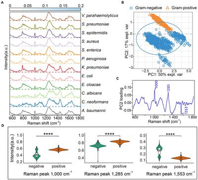 Identification of pathogens and detection of antibiotic susceptibility at single-cell resolution by Raman spectroscopy combined with machine learning